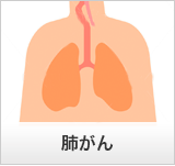 肺がん